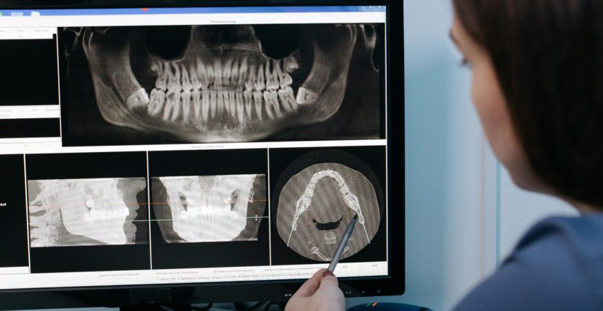 Bone Medications and Jaw Disease